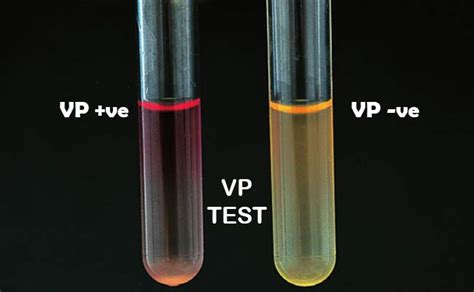Voges Proskauer Test .